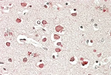 Anti-Neurobeachin antibody, C-term used in IHC (Paraffin sections) (IHC-P). GTX89207