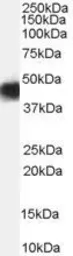 Anti-CCM2 antibody, Internal used in Western Blot (WB). GTX89245