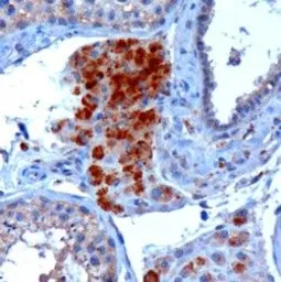 Anti-SBP2 antibody, Internal used in IHC (Paraffin sections) (IHC-P). GTX89253
