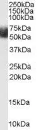 Anti-FBXL3 antibody, N-term used in Western Blot (WB). GTX89255