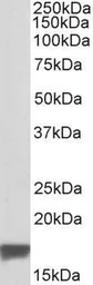 Anti-PBR antibody, C-term used in Western Blot (WB). GTX89258