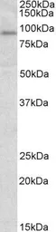 Anti-STAT3 antibody, Internal used in Western Blot (WB). GTX89276