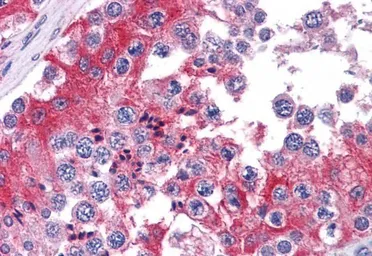 Anti-COMT antibody, Internal used in IHC (Paraffin sections) (IHC-P). GTX89277