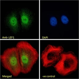 Anti-LEF1 antibody, Internal used in Immunocytochemistry/ Immunofluorescence (ICC/IF). GTX89284