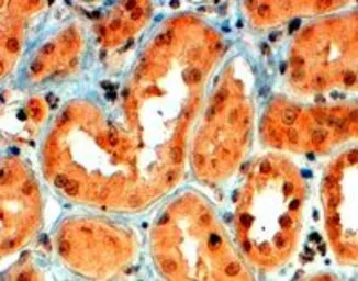 Anti-Semaphorin 5A antibody, Internal used in IHC (Paraffin sections) (IHC-P). GTX89289