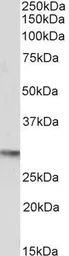 Anti-Oct4 antibody, C-term used in Western Blot (WB). GTX89295