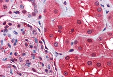 Anti-Radixin antibody, Internal used in IHC (Paraffin sections) (IHC-P). GTX89297