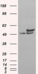 Anti-p54nrb antibody, C-term used in Western Blot (WB). GTX89315