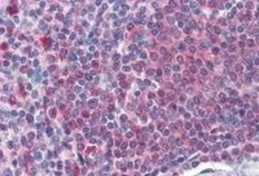 Anti-Catalase antibody, Internal used in IHC (Paraffin sections) (IHC-P). GTX89332