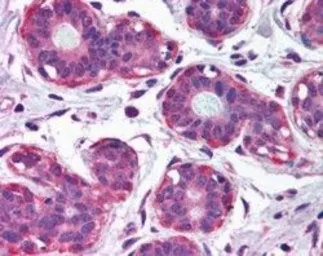 Anti-NET1 antibody, Internal used in IHC (Paraffin sections) (IHC-P). GTX89335