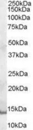 Anti-GCDFP15 antibody, Internal used in Western Blot (WB). GTX89351