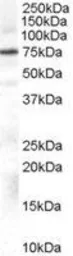 Anti-GRK2 antibody, Internal used in Western Blot (WB). GTX89353