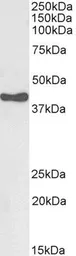 Anti-HSD3B1 antibody, C-term used in Western Blot (WB). GTX89377