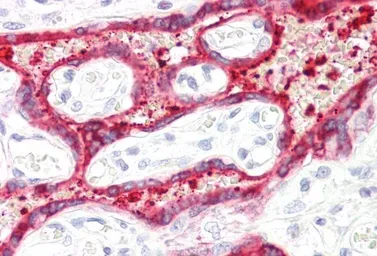 Anti-HSD3B1 antibody, C-term used in IHC (Paraffin sections) (IHC-P). GTX89377