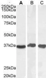 Anti-GAPDH antibody, Internal used in Western Blot (WB). GTX89409