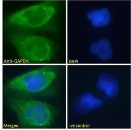 Anti-GAPDH antibody, Internal used in Immunocytochemistry/ Immunofluorescence (ICC/IF). GTX89409