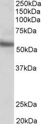 Anti-ERG antibody, C-term used in Western Blot (WB). GTX89421
