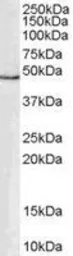 Anti-GATA1 antibody, Internal used in Western Blot (WB). GTX89442