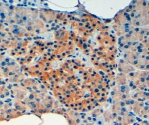 VPS11 antibody, Internal