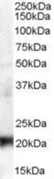 Anti-HP1 gamma antibody, Internal used in Western Blot (WB). GTX89454