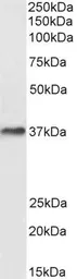 Anti-DARC antibody, N-term used in Western Blot (WB). GTX89467