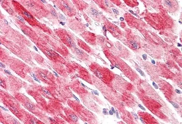 Anti-Cofilin 2 antibody, C-term used in IHC (Paraffin sections) (IHC-P). GTX89482