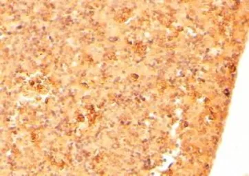 Anti-Cryptic antibody, Internal used in IHC (Paraffin sections) (IHC-P). GTX89499