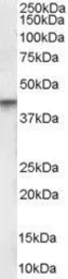 Anti-Vitamin D Receptor antibody, Internal used in Western Blot (WB). GTX89509