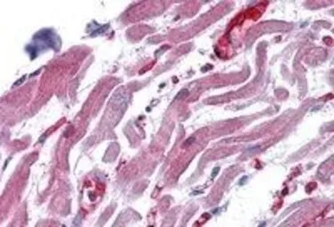 Anti-RAE1 antibody, C-term used in IHC (Paraffin sections) (IHC-P). GTX89517