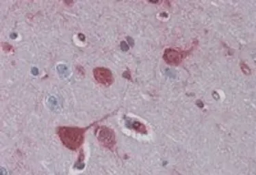 Anti-RAE1 antibody, C-term used in IHC (Paraffin sections) (IHC-P). GTX89517