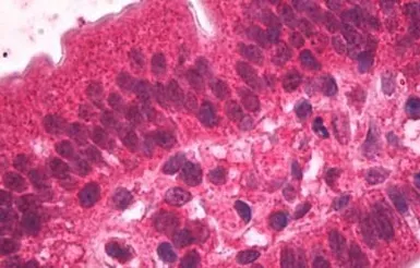 Anti-HNF4 alpha antibody, N-term used in IHC (Paraffin sections) (IHC-P). GTX89532