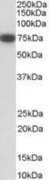 Anti-p75 NGF Receptor / CD271 antibody, Internal used in Western Blot (WB). GTX89556
