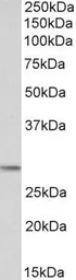 Anti-POMC antibody used in Western Blot (WB). GTX89560