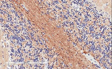 Anti-SNAP25 antibody, C-term used in IHC (Paraffin sections) (IHC-P). GTX89577