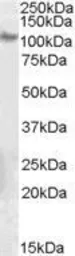 Anti-Integrin beta 5 antibody, C-term used in Western Blot (WB). GTX89579