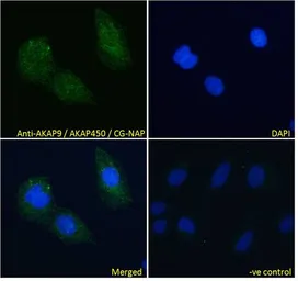 Anti-AKAP9 antibody, C-term used in Immunocytochemistry/ Immunofluorescence (ICC/IF). GTX89583