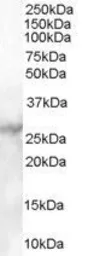Anti-MBL2 antibody, C-term used in Western Blot (WB). GTX89586