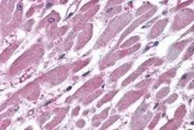 Anti-PPP2R1A antibody, C-term used in IHC (Paraffin sections) (IHC-P). GTX89587