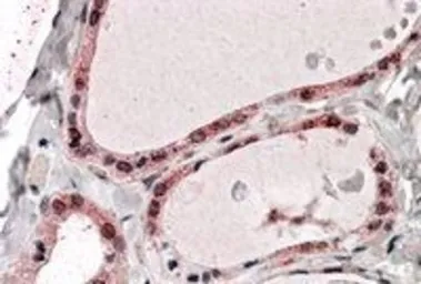 Anti-PPP2R1A antibody, C-term used in IHC (Paraffin sections) (IHC-P). GTX89587