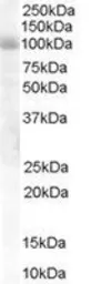 Anti-HPS6 antibody, Internal used in Western Blot (WB). GTX89591