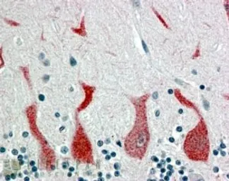 Anti-Retinoic Acid Receptor alpha antibody, C-term used in IHC (Paraffin sections) (IHC-P). GTX89607