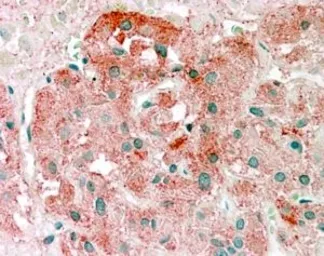 Anti-Semaphorin 3E antibody, C-term used in IHC (Paraffin sections) (IHC-P). GTX89609