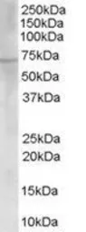 Anti-Choline Acetyltransferase antibody, C-term used in Western Blot (WB). GTX89623