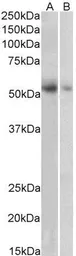 Anti-VMAT2 antibody, C-term used in Western Blot (WB). GTX89638