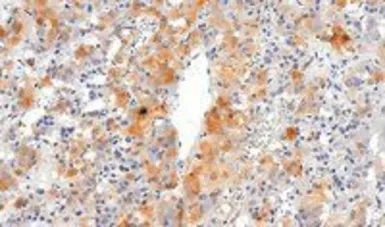 Anti-VMAT2 antibody, C-term used in IHC (Paraffin sections) (IHC-P). GTX89638