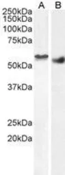 Anti-Clik1 / STK35 antibody, C-term used in Western Blot (WB). GTX89642