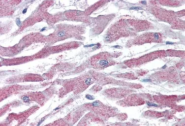 Anti-AKT3 antibody, Internal used in IHC (Paraffin sections) (IHC-P). GTX89647