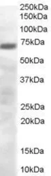 Anti-PRDM4 antibody, C-term used in Western Blot (WB). GTX89654