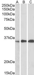 Anti-EFHD2 antibody, C-term used in Western Blot (WB). GTX89662