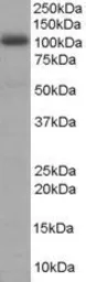 Anti-AKAP8 antibody, N-term used in Western Blot (WB). GTX89667